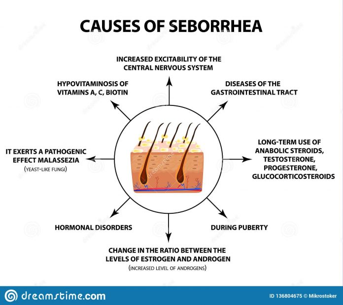 All You Need To Know About The Major Causes Of Seborrhea
