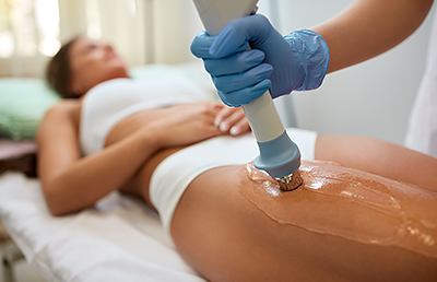 How To Get Rid Of Cellulite Through Carboxytherapy Treatment