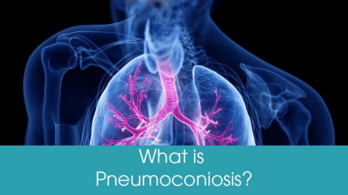 What You Should Know About Pneumoconiosis