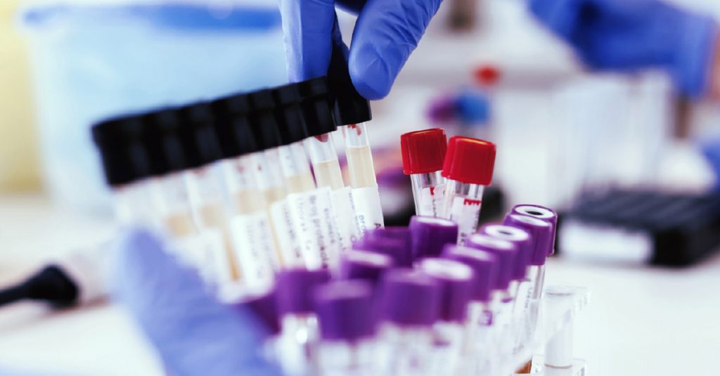 Instant Drug Testing vs. Lab-Based Testing What You Need to Know