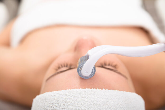 6 Reasons Why Microneedling is Good for You