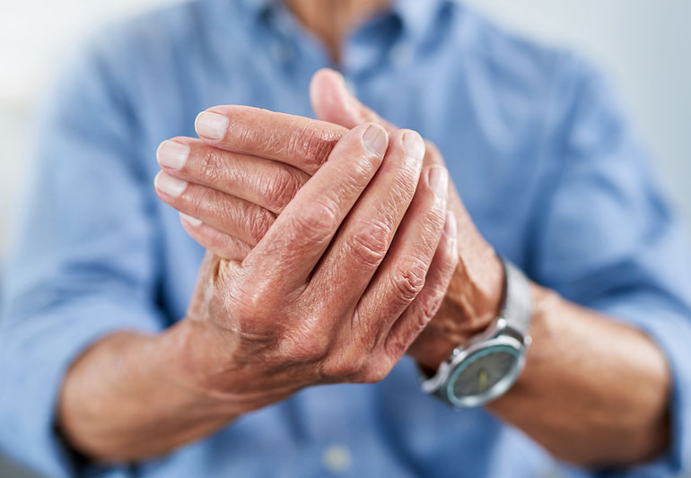 Myths and Misconceptions About Arthritis
