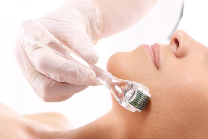What Microneedling Entails