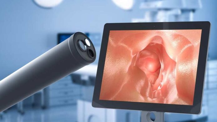 Colonoscopy When You Need It, Risks, and How to Prepare