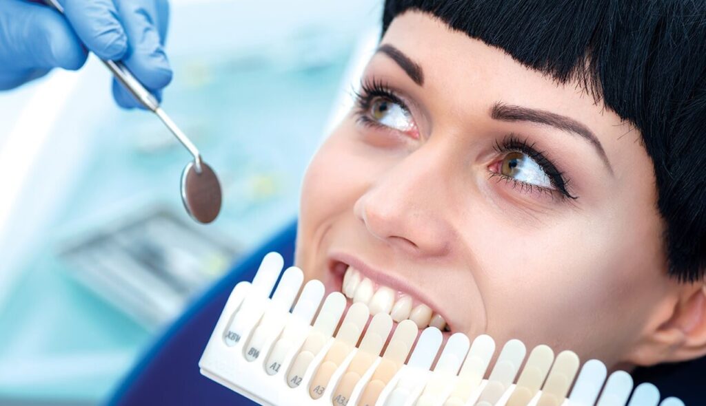Teeth Whitening and Why It Is Important