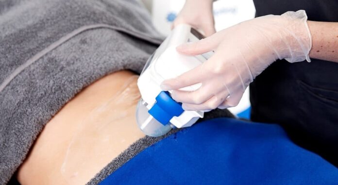 How Many Coolsculpting® Sessions Will You Require?