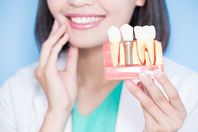 Are Implant-Supported Dentures Suitable for Me? (FAQs)