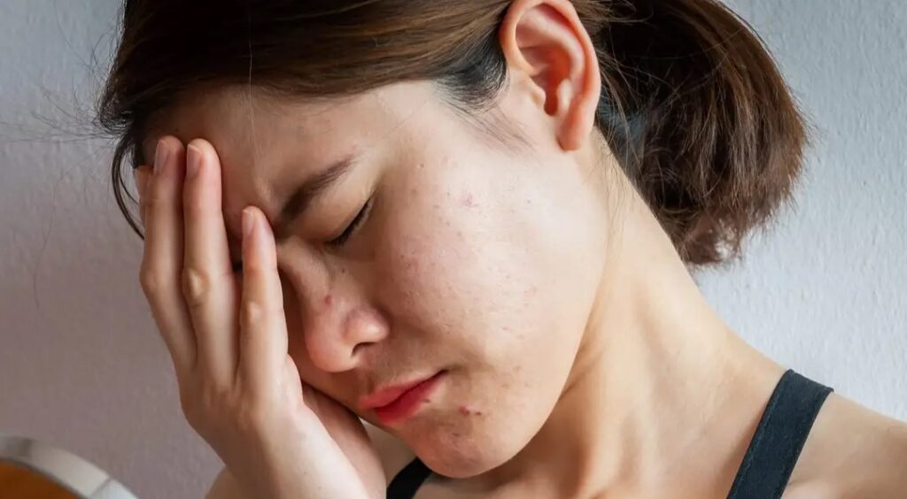 Could Dehydration Be Exacerbating Your Stress-Related Skin Breakouts?
